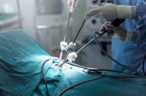 Umbilical hernia Doctor in Kanpur 